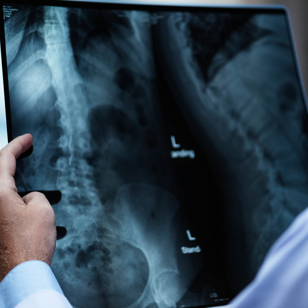 Hare Wynn Trial Lawyers - Trusted Medical Malpractice Lawyer in Brook Highland AL - Misdiagnosis & Delayed Diagnosis