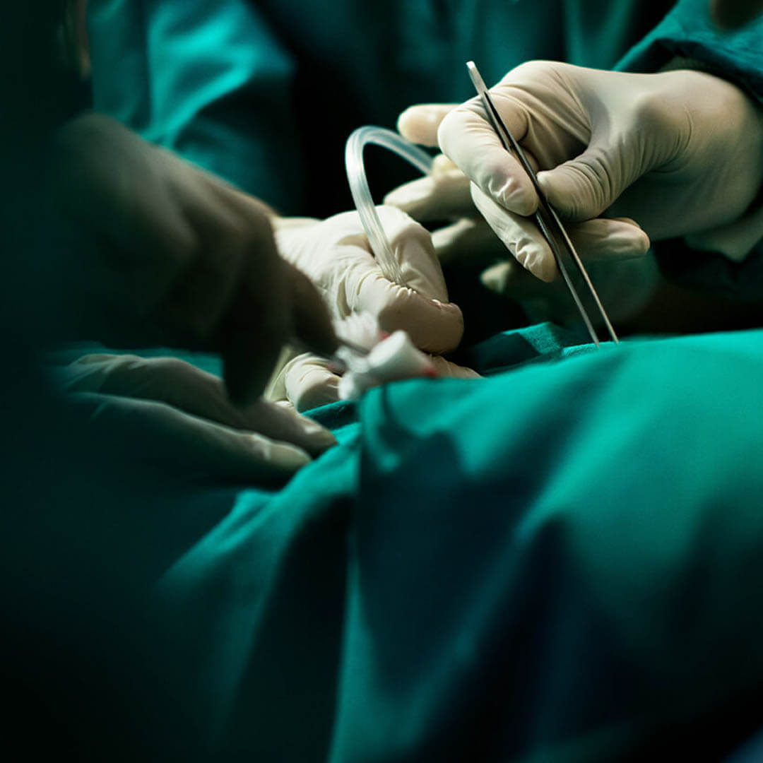 Hare Wynn Trial Lawyers - Reputable Medical Malpractice Lawyer in Mobile AL - Surgical Errors